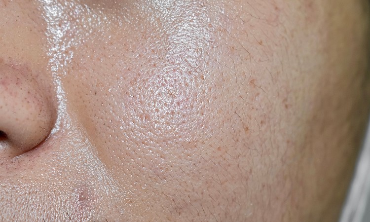 皮脂がベタつきやテカリの原因！？そもそも皮脂とは？