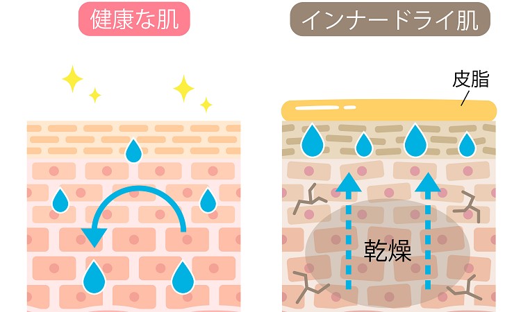 潤いを徹底チャージ！「夏のインナードライ」を解消