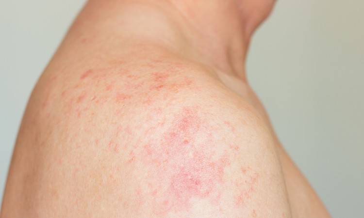 肌質とボディソープ選びの基本