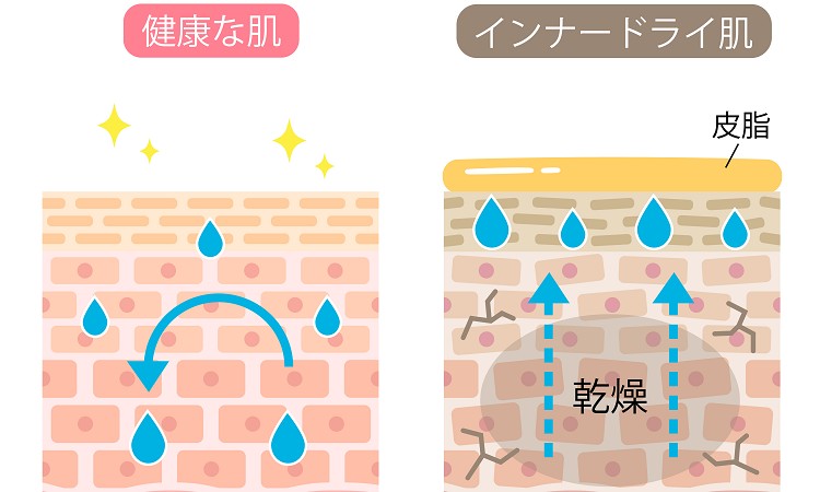 インナードライ肌のメカニズム